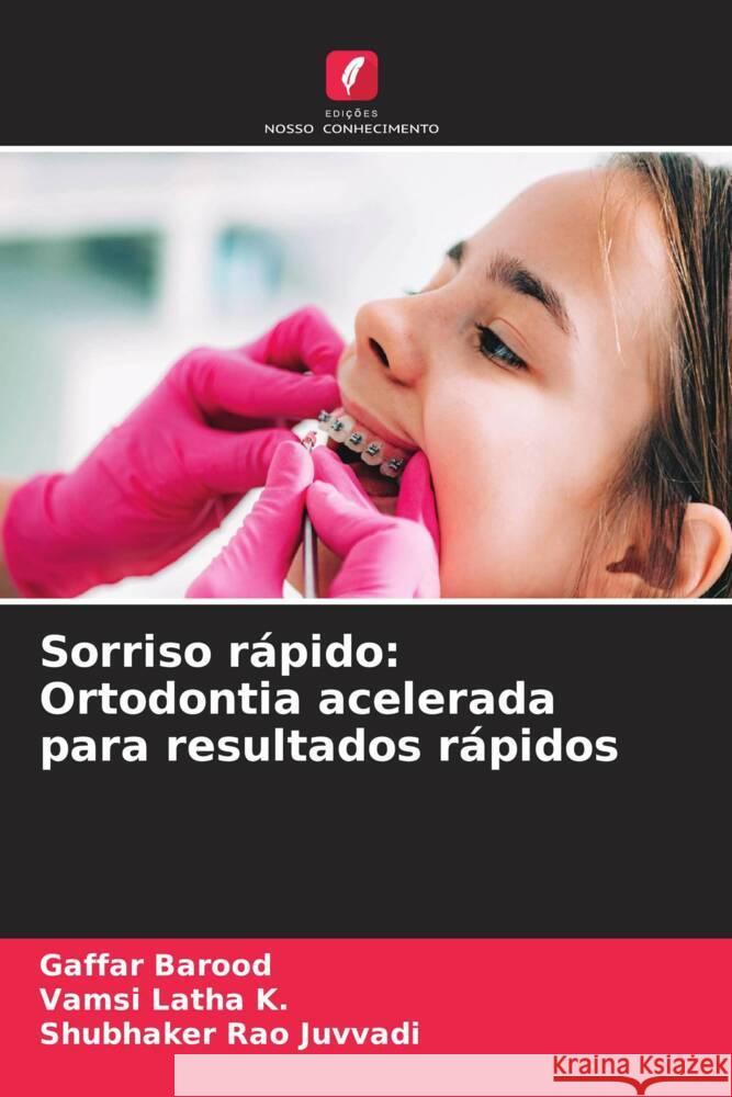 Sorriso r?pido: Ortodontia acelerada para resultados r?pidos Gaffar Barood Vamsi Lath Shubhaker Rao Juvvadi 9786207972715 Edicoes Nosso Conhecimento - książka