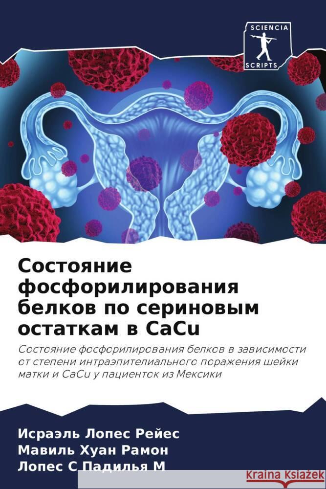 Sostoqnie fosforilirowaniq belkow po serinowym ostatkam w CaCu Lopes Rejes, Israäl', Huan Ramon, Mawil', Padil'q M, Lopes S 9786206301745 Sciencia Scripts - książka