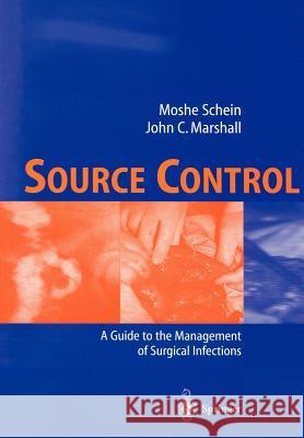 Source Control: A Guide to the Management of Surgical Infections Schein, Moshe 9783540429739 Springer - książka