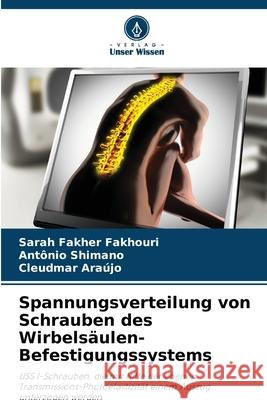 Spannungsverteilung von Schrauben des Wirbelsäulen-Befestigungssystems Fakher Fakhouri, Sarah, Shimano, Antônio, Araújo, Cleudmar 9786208740863 Verlag Unser Wissen - książka