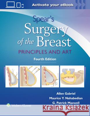 Spear's Surgery of the Breast: Principles and Art Allen Gabriel 9781496397010 LWW - książka