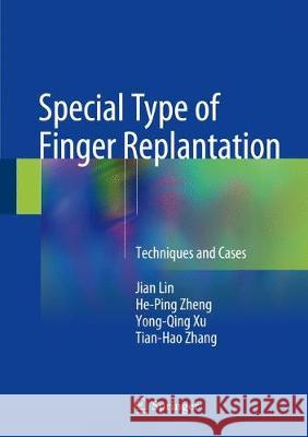 Special Type of Finger Replantation: Techniques and Cases Lin, Jian 9789811062285 Springer - książka