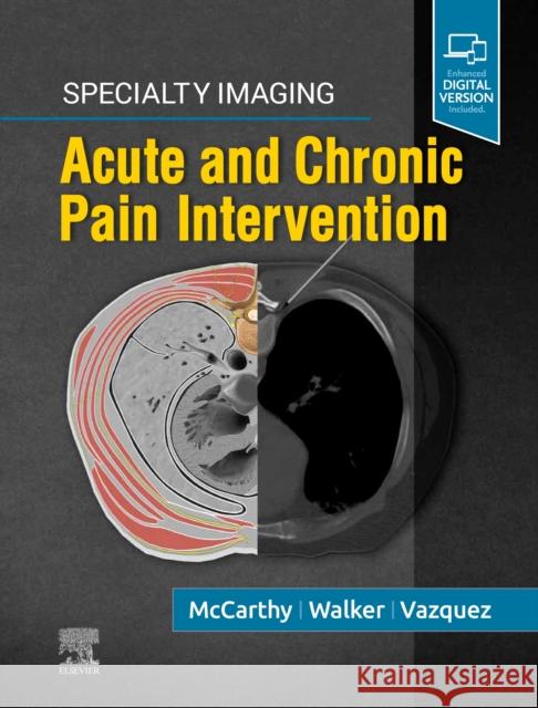Specialty Imaging: Acute and Chronic Pain Intervention Colin J. McCarthy T. Gregory Walker Rafael Vazquez 9780323680363 Elsevier - książka