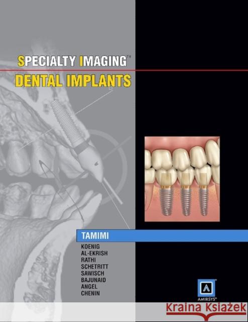 Specialty Imaging: Dental Implants Dania Faisal Tamimi 9781937242190 Amirsys - książka