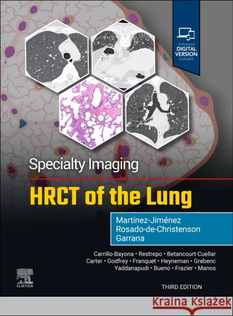 Specialty Imaging: Hrct of the Lung Santiago Mart?nez-Jim?nez Melissa L. Rosado-De-Christenson Sherief Garrana 9780443286360 Elsevier - książka