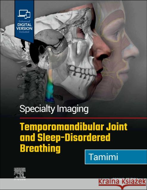 Specialty Imaging: Temporomandibular Joint and Sleep-Disordered Breathing Dania F. Tamimi 9780323877480 Elsevier - książka