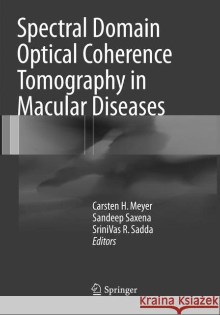 Spectral Domain Optical Coherence Tomography in Macular Diseases  9788132238652 Springer - książka