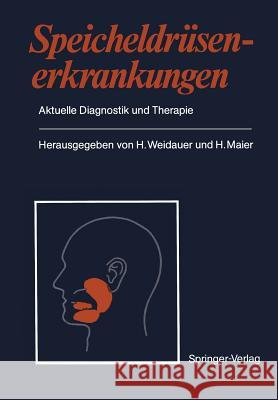 Speicheldrüsenerkrankungen: Aktuelle Diagnostik Und Therapie Weidauer, H. 9783642733406 Springer - książka