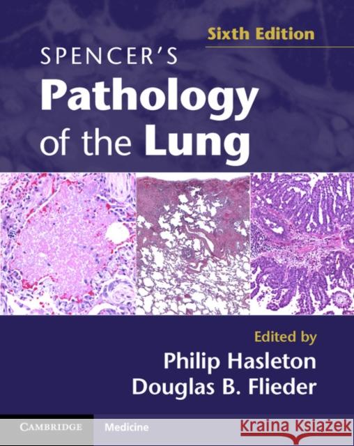 Spencer's Pathology of the Lung 2 Part Set with DVDs [With DVD] Hasleton, Philip 9780521509954 CAMBRIDGE UNIVERSITY PRESS - książka