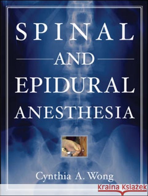Spinal and Epidural Anesthesia Cynthia Wong 9780071437721 McGraw-Hill Professional Publishing - książka