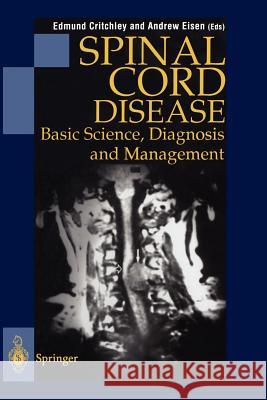 Spinal Cord Disease: Basic Science, Diagnosis and Management Critchley, Edmund 9781447112334 Springer - książka