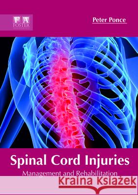 Spinal Cord Injuries: Management and Rehabilitation Peter Ponce 9781632425683 Foster Academics - książka