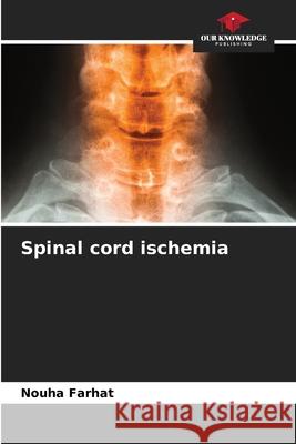 Spinal cord ischemia Nouha Farhat 9786207904341 Our Knowledge Publishing - książka