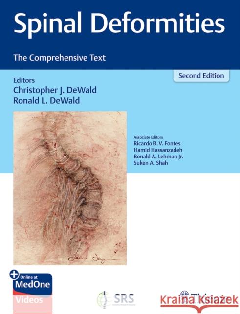 Spinal Deformities: The Comprehensive Text DeWald, Christopher 9781626233720 Thieme Medical Publishers Inc - książka