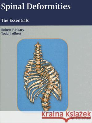 Spinal Deformities: The Essentials Robert F. Heary Todd J. Albert 9781588903419 Thieme Medical Publishers - książka