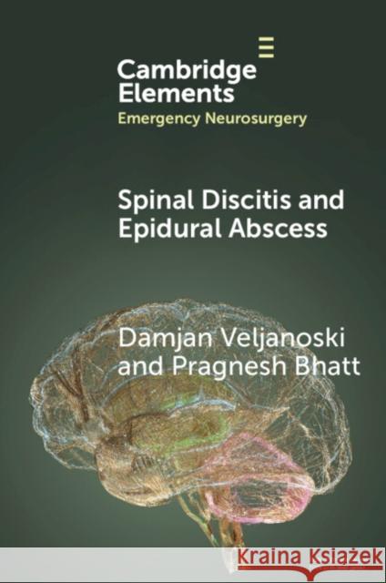 Spinal Discitis and Epidural Abscess Pragnesh (Aberdeen Royal Infirmary and University of Aberdeen) Bhatt 9781009409407 Cambridge University Press - książka