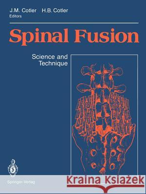 Spinal Fusion: Science and Technique Cotler, Jerome M. 9781461279440 Springer - książka