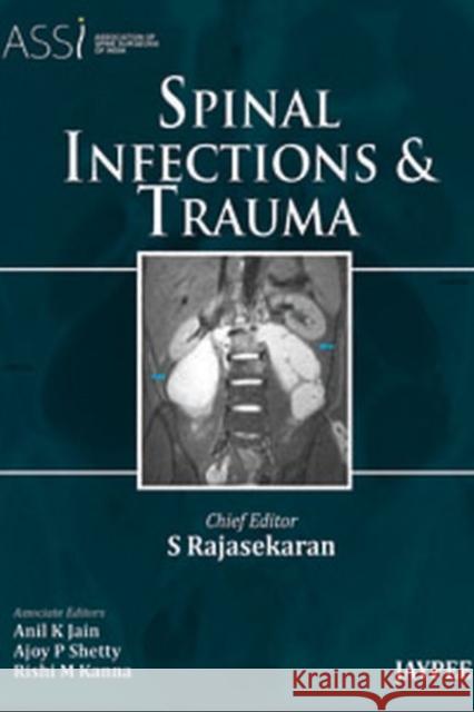 Spinal Infections and Trauma S. Rajasekaran   9789350250754 Jaypee Brothers Medical Publishers - książka