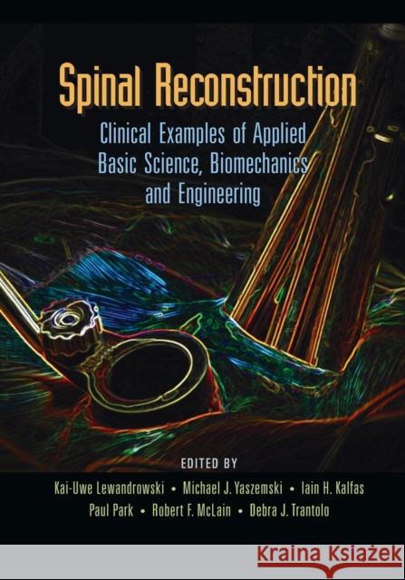 Spinal Reconstruction: Clinical Examples of Applied Basic Science, Biomechanics and Engineering Kai-Uwe Lewandrowski Michael J. Yaszemski Iain Kalfas 9780367389499 CRC Press - książka