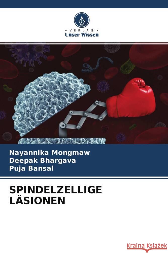 SPINDELZELLIGE LÄSIONEN Mongmaw, Nayannika, Bhargava, Deepak, Bansal, Puja 9786204380865 Verlag Unser Wissen - książka