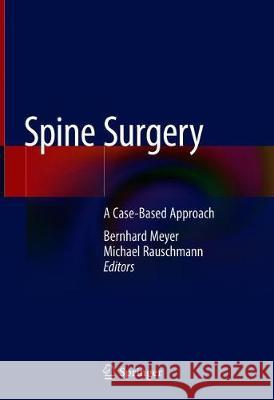 Spine Surgery: A Case-Based Approach Meyer, Bernhard 9783319988740 Springer - książka