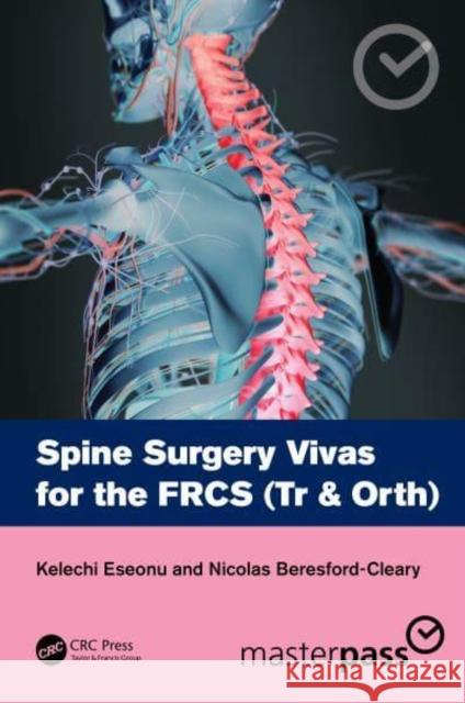 Spine Surgery Vivas for the Frcs (Tr & Orth) Kelechi Eseonu Nicolas Beresford-Cleary 9781032062358 CRC Press - książka