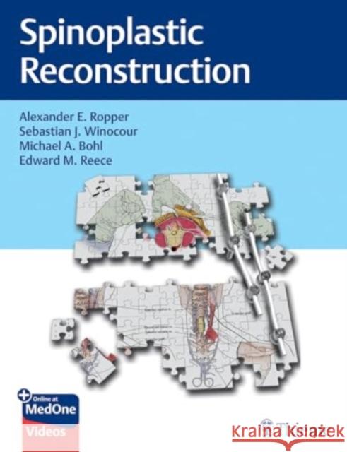 Spinoplastic Reconstruction Alexander Ropper Sebastian Winocour Michael Bohl 9781684205011 Thieme Medical Publishers - książka