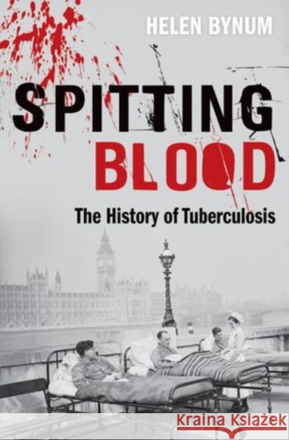 Spitting Blood: The history of tuberculosis Helen (Freelance historian) Bynum 9780198727514 Oxford University Press - książka