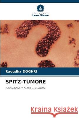 Spitz-Tumore Raoudha Doghri 9786205293225 Verlag Unser Wissen - książka