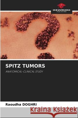 Spitz Tumors Raoudha Doghri 9786205293232 Our Knowledge Publishing - książka