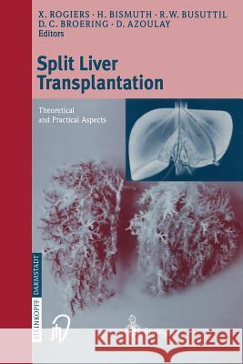 Split Liver Transplantation: Theoretical and Practical Aspects Rogiers, X. 9783798512566 Springer - książka