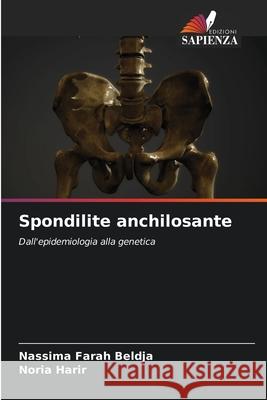 Spondilite anchilosante Beldja, Nassima Farah, Harir, Noria 9786209585531 Edizioni Sapienza - książka