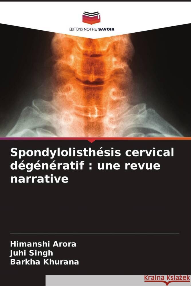 Spondylolisthésis cervical dégénératif : une revue narrative Arora, Himanshi, Singh, Juhi, Khurana, Barkha 9786206479819 Editions Notre Savoir - książka