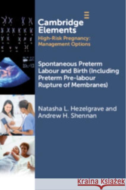 Spontaneous Preterm Labour and Birth (Including Preterm Pre-labour Rupture of Membranes) Andrew (King's College London) Shennan 9781009508919 Cambridge University Press - książka