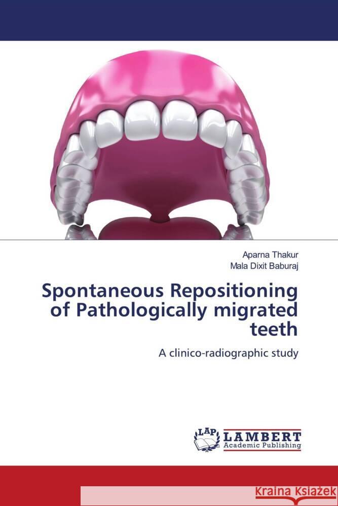 Spontaneous Repositioning of Pathologically migrated teeth Thakur, Aparna, Baburaj, Mala Dixit 9786202199445 LAP Lambert Academic Publishing - książka