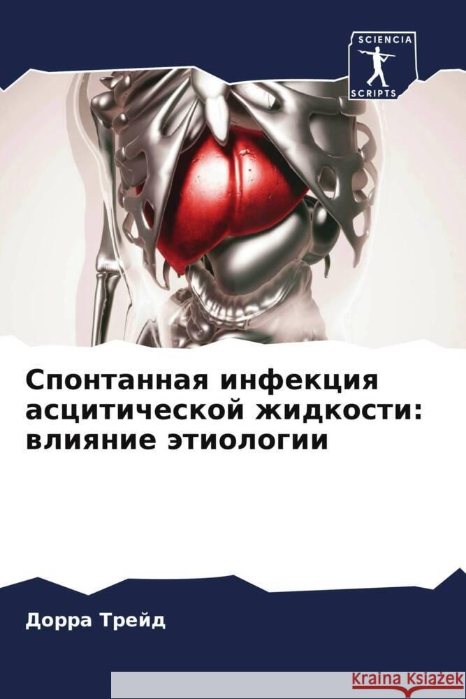 Spontannaq infekciq asciticheskoj zhidkosti: wliqnie ätiologii Trejd, Dorra, Zhlassi, Housseina, Sabbah, Meriam 9786204390277 Sciencia Scripts - książka