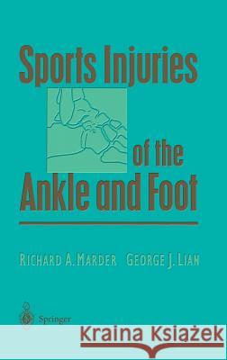 Sports Injuries of the Ankle and Foot Richard A. Marder J. Green George J. Lian 9780387946870 Springer - książka