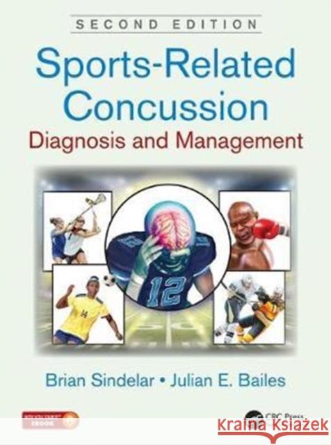 Sports-Related Concussion: Diagnosis and Management, Second Edition Brian Sindelar Julian E. Bailes Brian Sindelar 9781498764575 CRC Press - książka