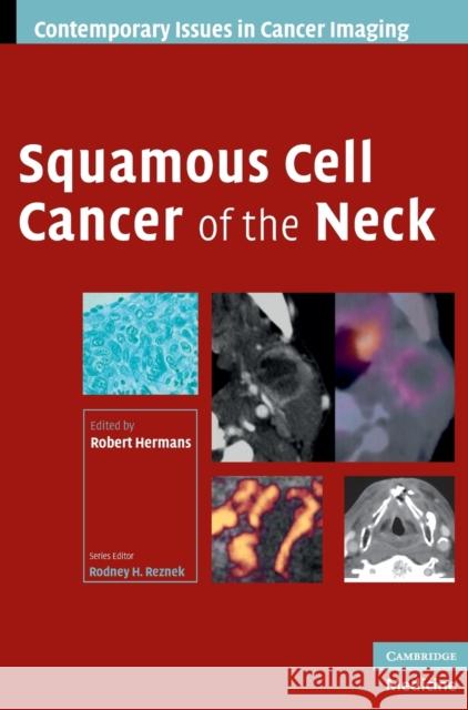 Squamous Cell Cancer of the Neck Robert Hermans 9780521886918 Cambridge University Press - książka