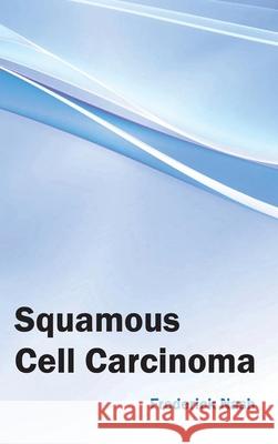 Squamous Cell Carcinoma Frederick Nash 9781632423795 Foster Academics - książka