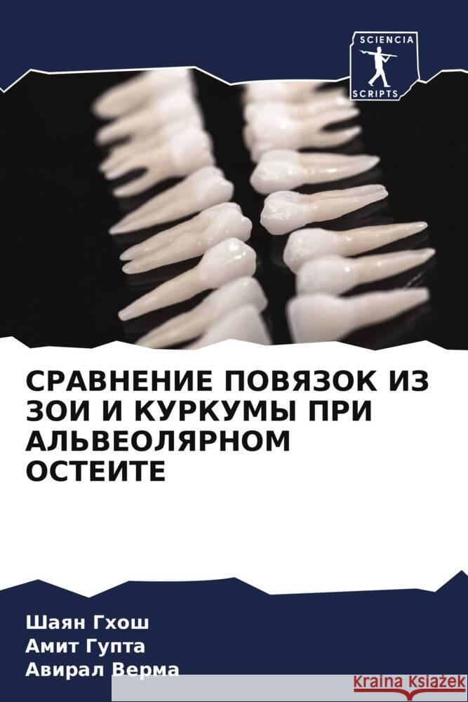 SRAVNENIE POVYaZOK IZ ZOI I KURKUMY PRI AL'VEOLYaRNOM OSTEITE Ghosh, Shaqn, Gupta, Amit, Verma, Awiral 9786208053994 Sciencia Scripts - książka