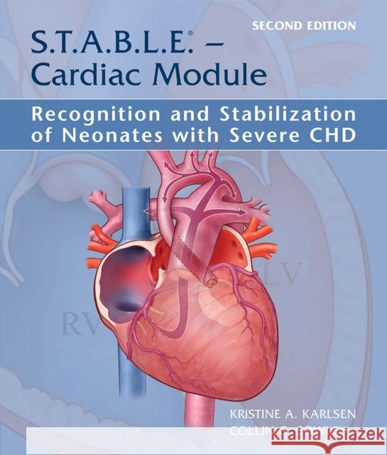S.T.A.B.L.E. - Cardiac Module: Recognition and Stabilization of Neonates with Severe Chd Kristine A. Karlsen Collin G. Cowley 9781937967178 American Academy of Pediatrics - książka