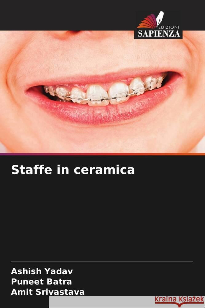 Staffe in ceramica Ashish Yadav Puneet Batra Amit Srivastava 9786207160563 Edizioni Sapienza - książka