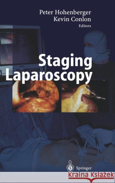 Staging Laparoscopy Daniel F. Heinz Peter Hohenberger Kevin Conlon 9783540656326 Springer - książka