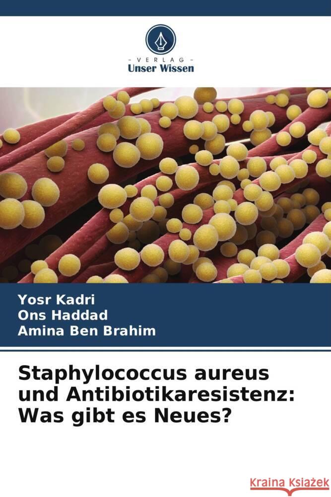 Staphylococcus aureus und Antibiotikaresistenz: Was gibt es Neues? Kadri, Yosr, Haddad, Ons, Ben Brahim, Amina 9786208329907 Verlag Unser Wissen - książka