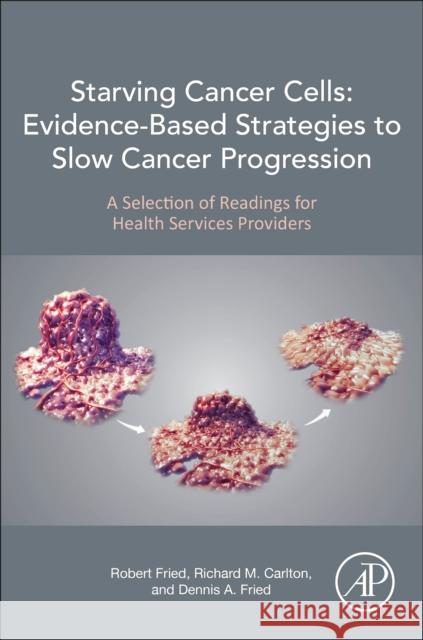 Starving Cancer Cells: Evidence-Based Strategies to Slow Cancer Progression: A Selection of Readings for Health Services Providers Robert Fried Richard M. Carlton Dennis A. Fried 9780128240137 Academic Press - książka