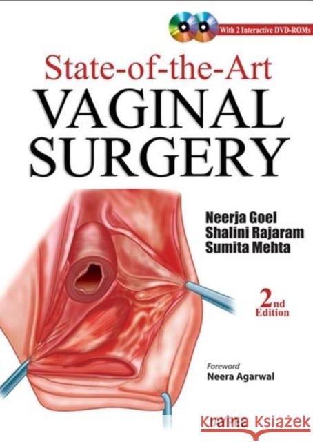 State-of-the-Art Vaginal Surgery Neerja Goel 9789350902875 Jaypee Brothers Medical Publishers - książka