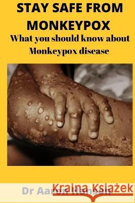 Stay Safe from Monkeypox: What You Should Know About Monkeypox Disease Dr Aaron Hanson 9798844026911 Independently Published - książka