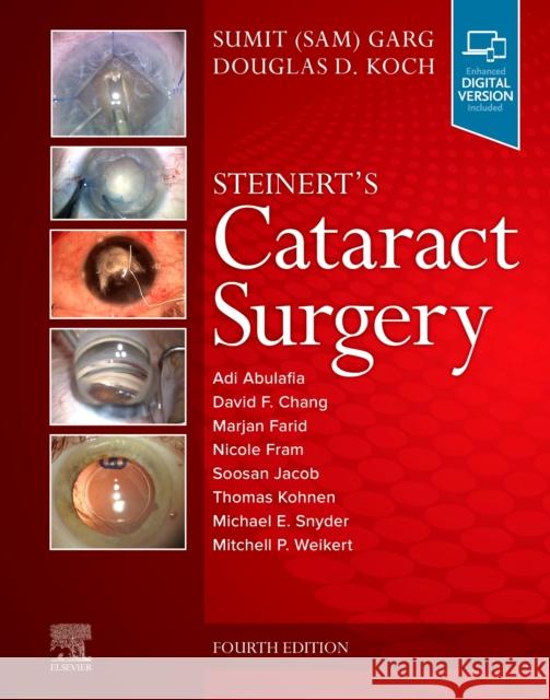 Steinert's Cataract Surgery Sumit Garg Douglas D. Koch 9780323568111 Elsevier - Health Sciences Division - książka