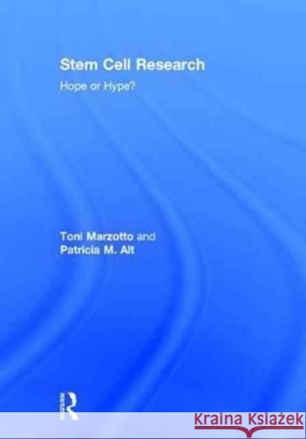 Stem Cell Research: Hope or Hype? Patricia M. Alt Toni Marzotto Linda Caplis 9781498756549 CRC Press - książka
